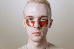 Genzugang für Schmetterlingskinder